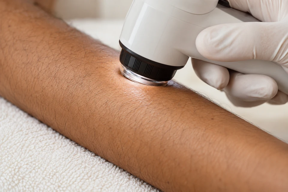 A handheld device used on the skin of the arm
